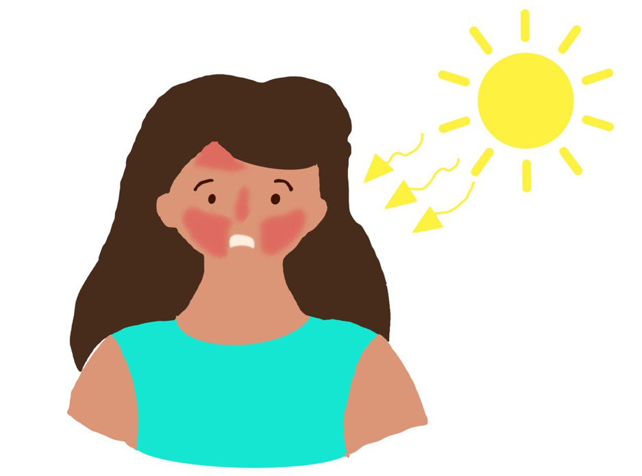 Skin protection from Sunburn